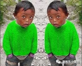 b超推算孕周怎么计算,胎芽长度计算孕周公式