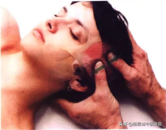 颞部头痛怎么办快速缓解,拉伸颞肌缓解偏头痛