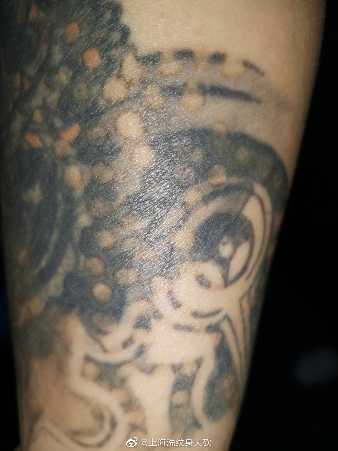 现在最好的洗纹身方法,纹身有哪些洗纹身方法