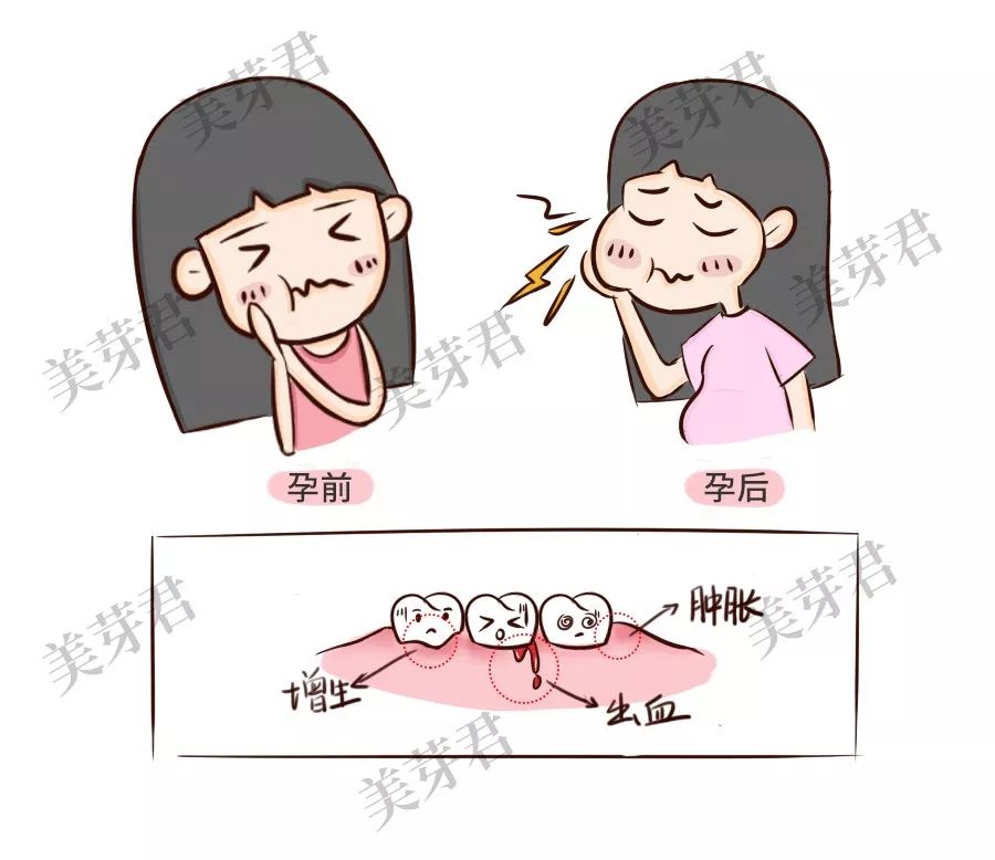 怀孕了牙疼能不能去医院看牙医,牙疼怀孕可以看牙吗