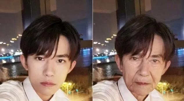 硬刚女皇龙妈也扛不住法令纹，2条沟壑让人心疼，贴一贴就消了