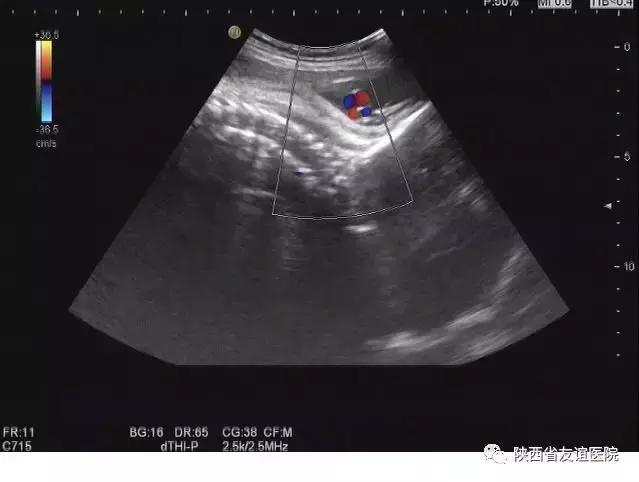 孕妇超声检查不良影响,孕妇超声检查的几大误区