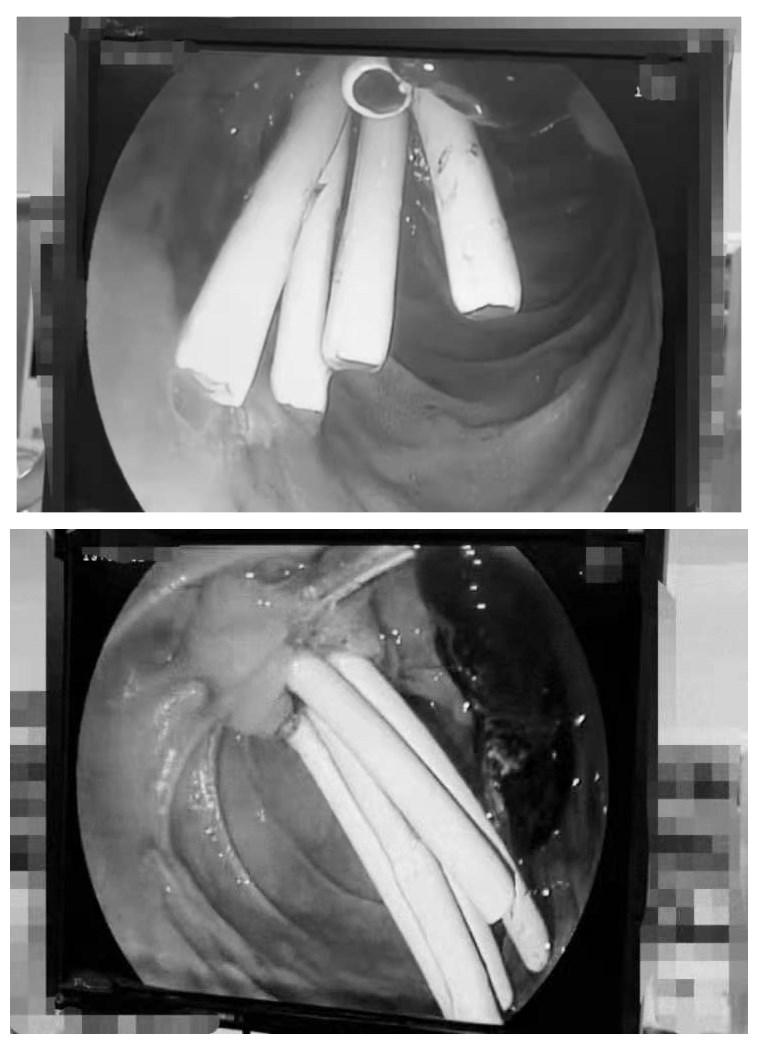 南大二附院红角洲分院具体位置,南大二附院红角洲分院优势