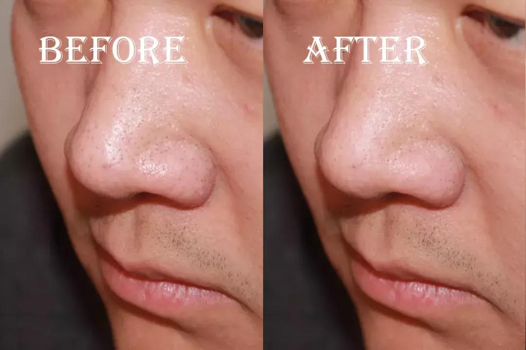 去黑头牙膏真实测评,牙膏去黄口测评