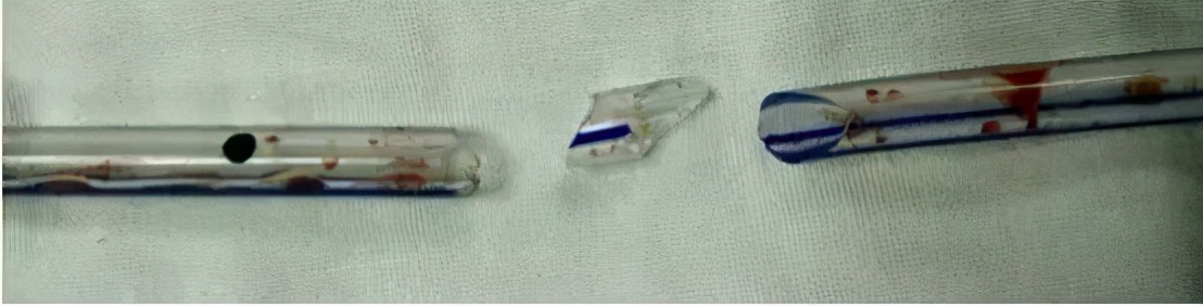 关于放置与拔除引流管那点事,你掌握了吗?