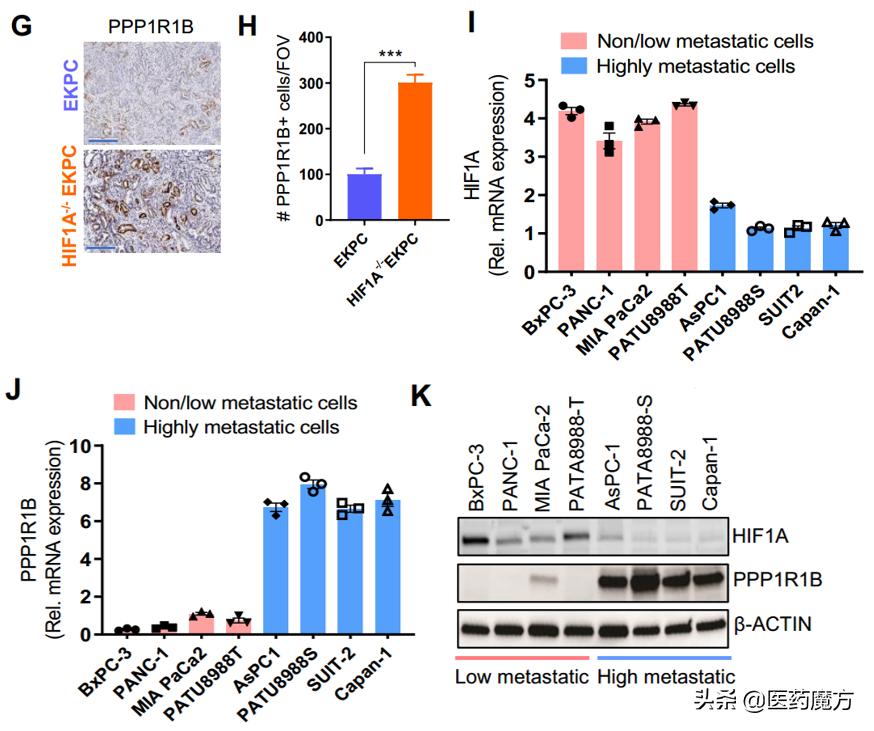 胰腺癌新靶点,胰腺癌tp53基因突变靶向药