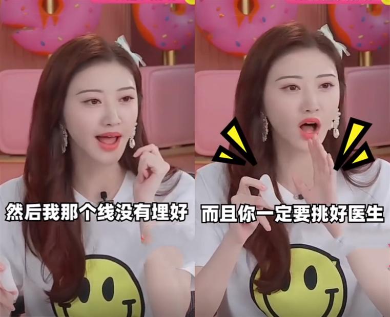 景甜自曝割双眼皮经历,景甜悲伤蛙双眼皮