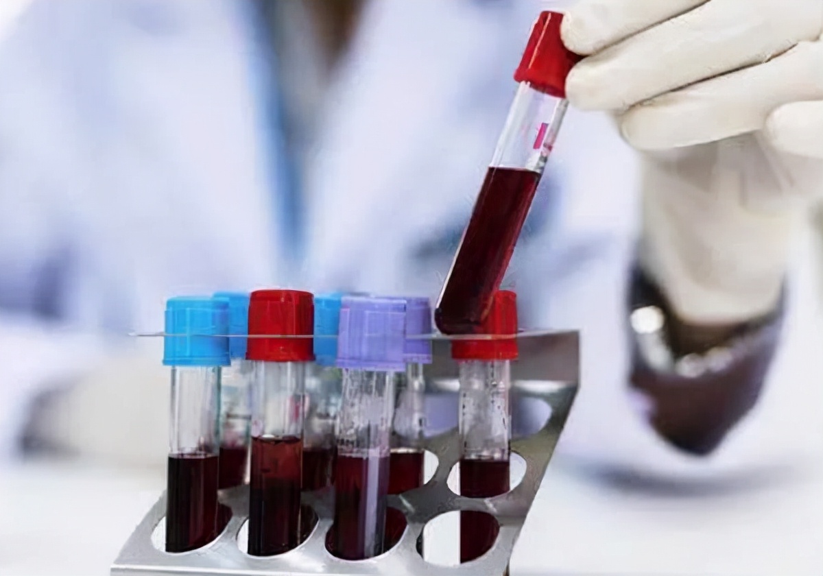 男子脚扭伤查出肾衰竭，为何年轻人易得肾病？这4点可修复肾功能