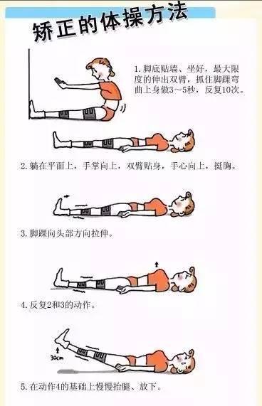 腿型管理腿不直改善各种不良腿型,腿部粗壮一般都会有腿型问题吗