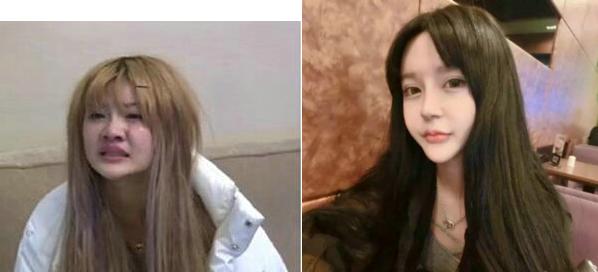 韩安冉整容失败案例,韩安冉整容教科书