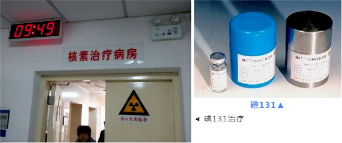 甲亢性眼突婴儿,8岁的小孩得了甲亢能自愈吗