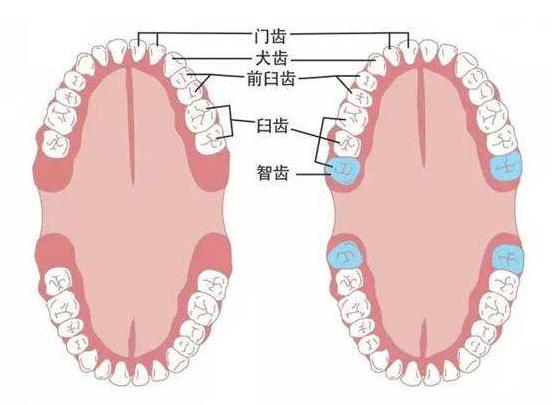 所有人拔智齿都会肿吗,智齿拔了以后智齿还有什么用