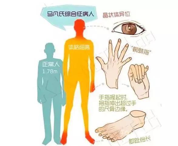 主动脉夹层破裂原因可能是外因吗,主动脉夹层血管破裂是什么病