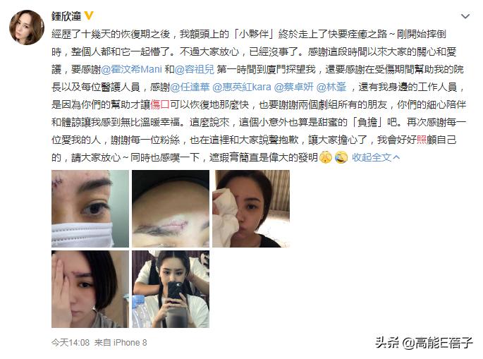 阿娇额头伤口恢复过程,阿娇晒伤口恢复照