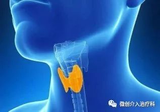 甲状腺结节微创消融手术,甲状腺结节微创消融医保