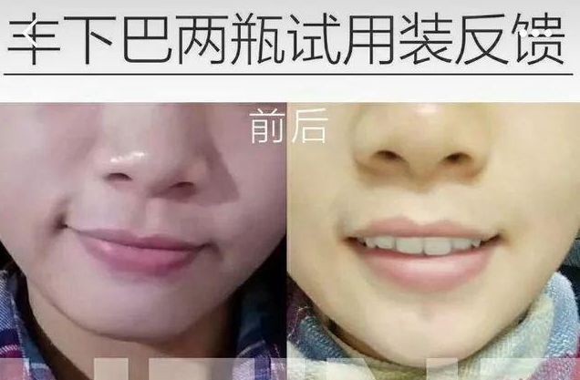 小红书能长大吗,小红书还能火多长时间