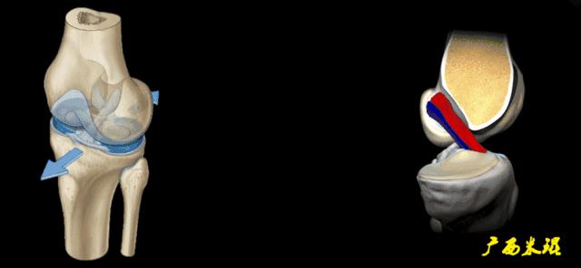 前交叉韧带扭伤最快自愈方法,前交叉韧带损伤膝关节会疼吗