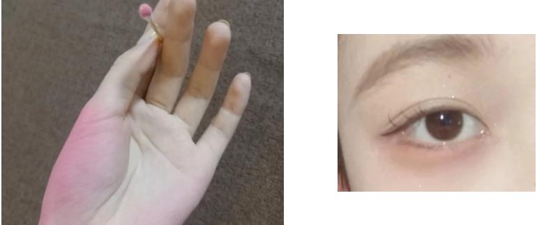 卧蚕饱满神器,最火爆的卧蚕神器