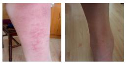 拍打膀胱有什么好处,拍打膀胱有助排尿吗