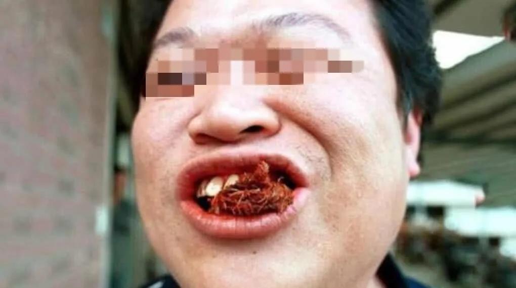 一级致癌物列表名单大全,一级致癌物被揪出