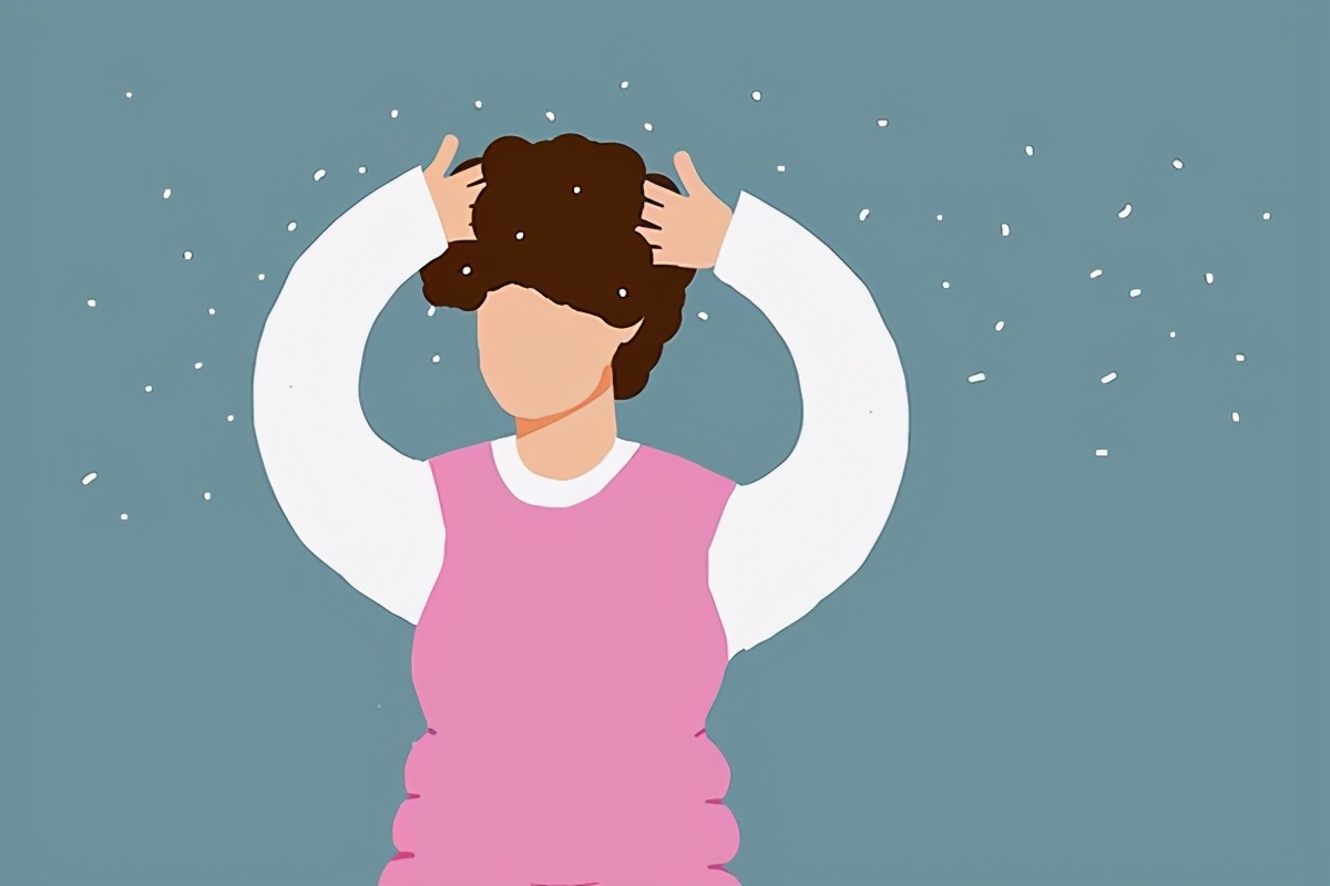 如何去除大块头皮屑你有哪些经验,偶尔头皮屑多怎么去除最简单方法