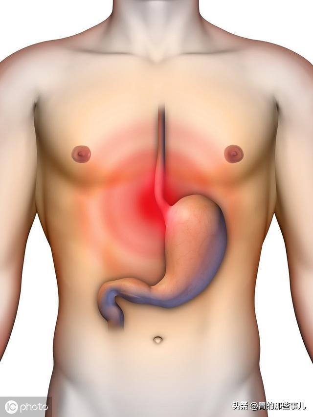 胆汁反流性胃炎后期会如何发展,胆汁反流性胃炎因为什么引起的