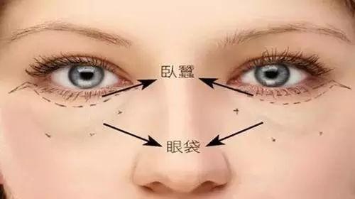 做了内切眼袋手术流泪会很刺痛,做完内切眼袋流眼泪有血