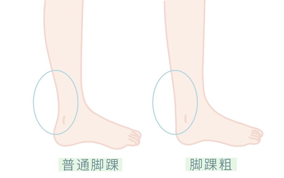 磨脚鞋不合脚,磨脚是因为鞋小吗