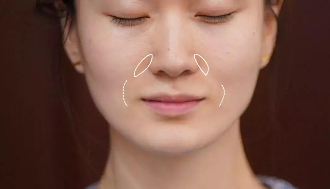 整牙一年半,这次重点说说整牙给我带来的小困扰