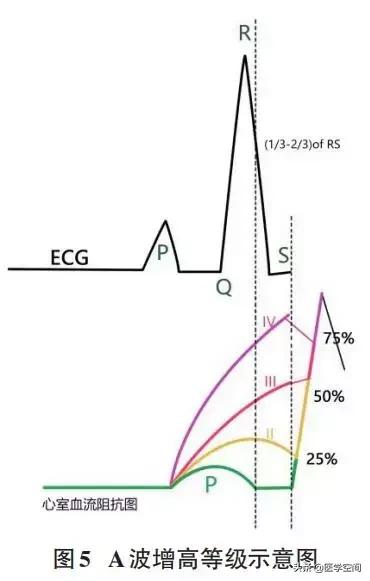 心血管疾病早期心脏康复专家共识,心脏康复护理专家共识解读