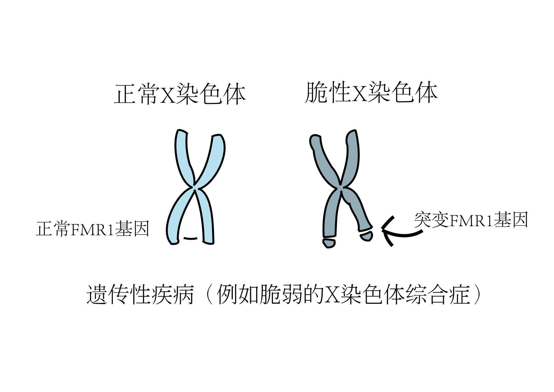 星星的孩子自闭症高清图片,星星的孩子自闭症可以变正常吗