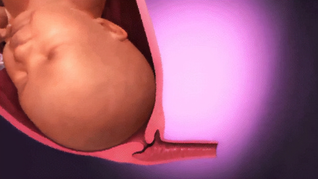 胎儿那么大为什么能生出来,胎儿太大如何让他发动