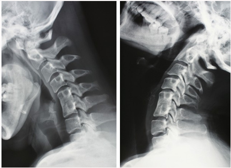 新手俯卧撑该怎么练才有效,俯卧撑的八个风险