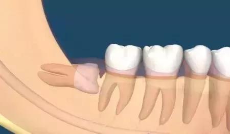 整牙后笑容会变好看吗,smilelab笑盈测评