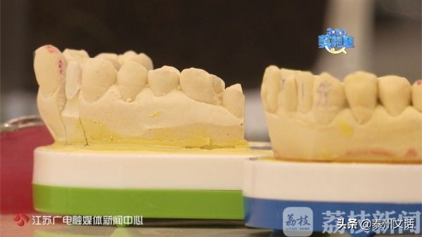 超强美白牙贴,网红美白牙笔有没有用