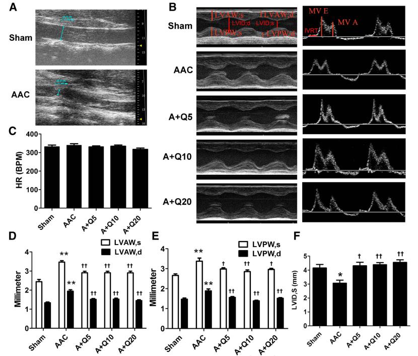 槲皮素对治疗肺部疾病有效果吗,槲皮素的抗炎免疫及部分机制研究