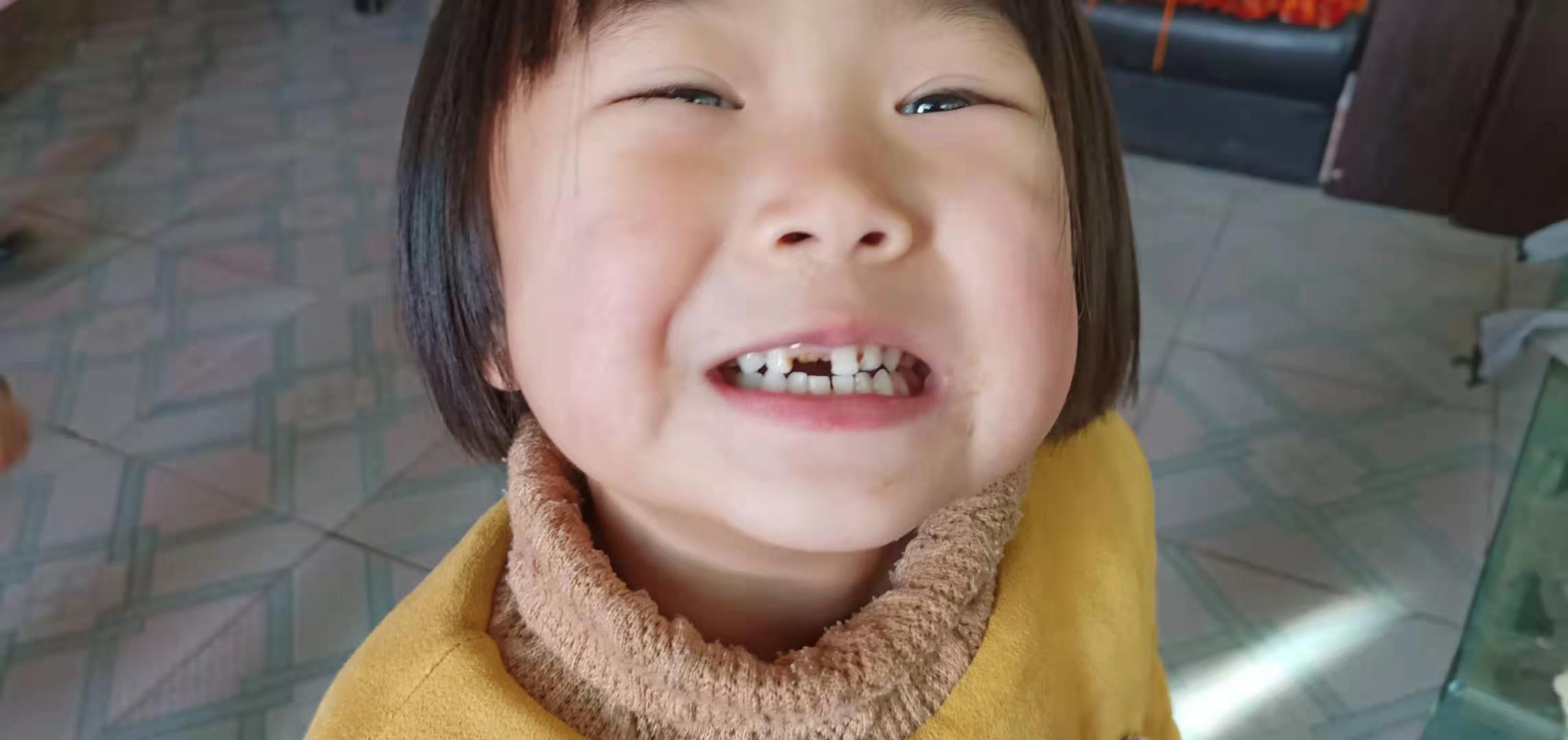 5岁儿童长蛀牙了会换牙吗,孩子蛀牙是不是换了新牙就没事了