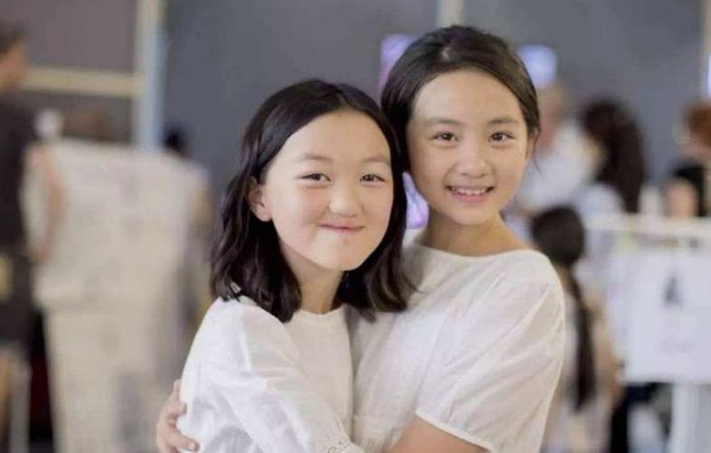 李嫣兔唇是不是很严重,李嫣兔唇现在怎么样了