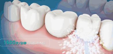 小米冲牙器伤牙,小米有品冲牙器头