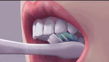 蛀牙总是一颗接着一颗？看来你不只是需要补牙了