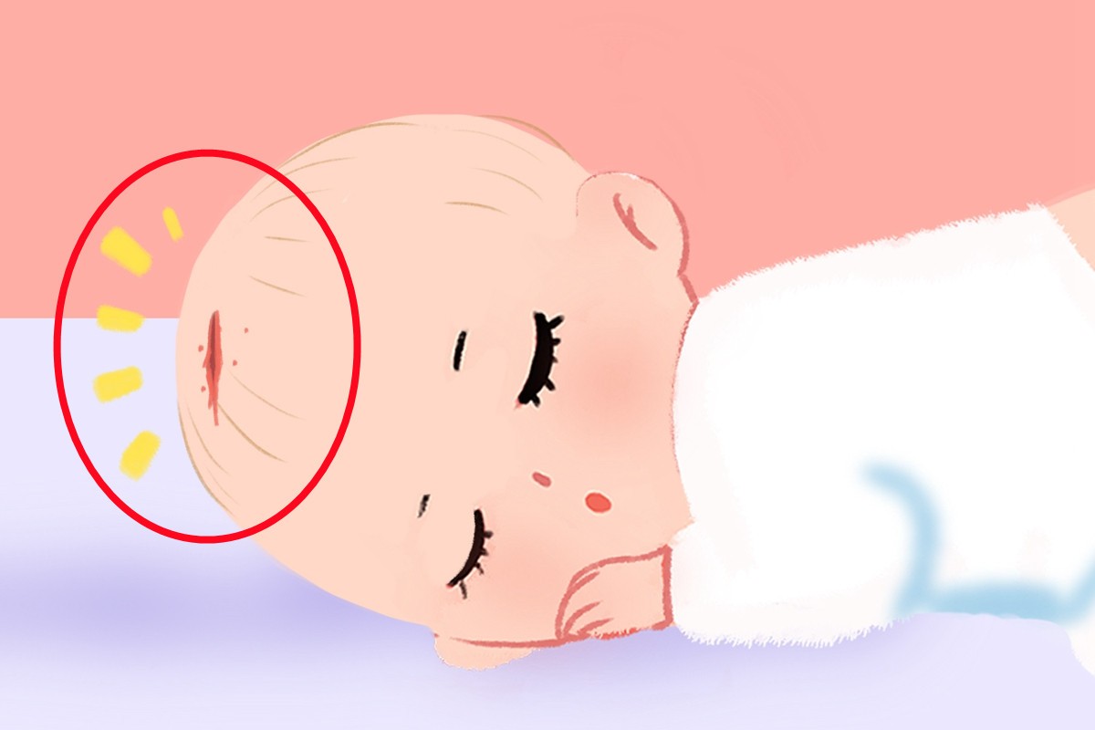 顺产剖产哪个对孕妇好,顺产剖腹产哪种对女人好