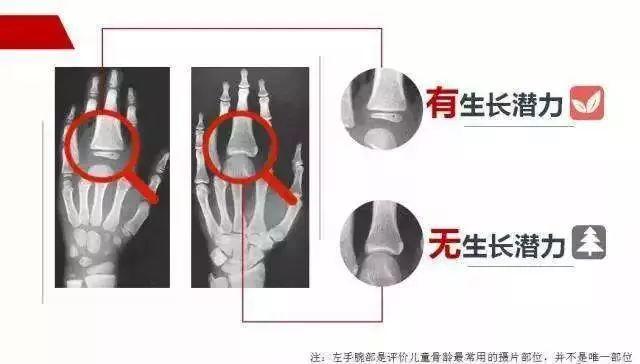 家长做什么能长高,家长帮孩子长高的运动方法