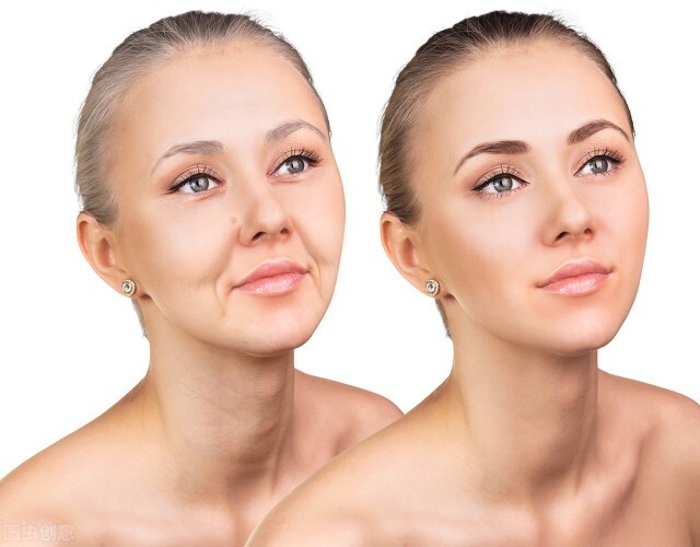 公认最好淡斑精华olay,olay光感小白瓶精华液好用吗