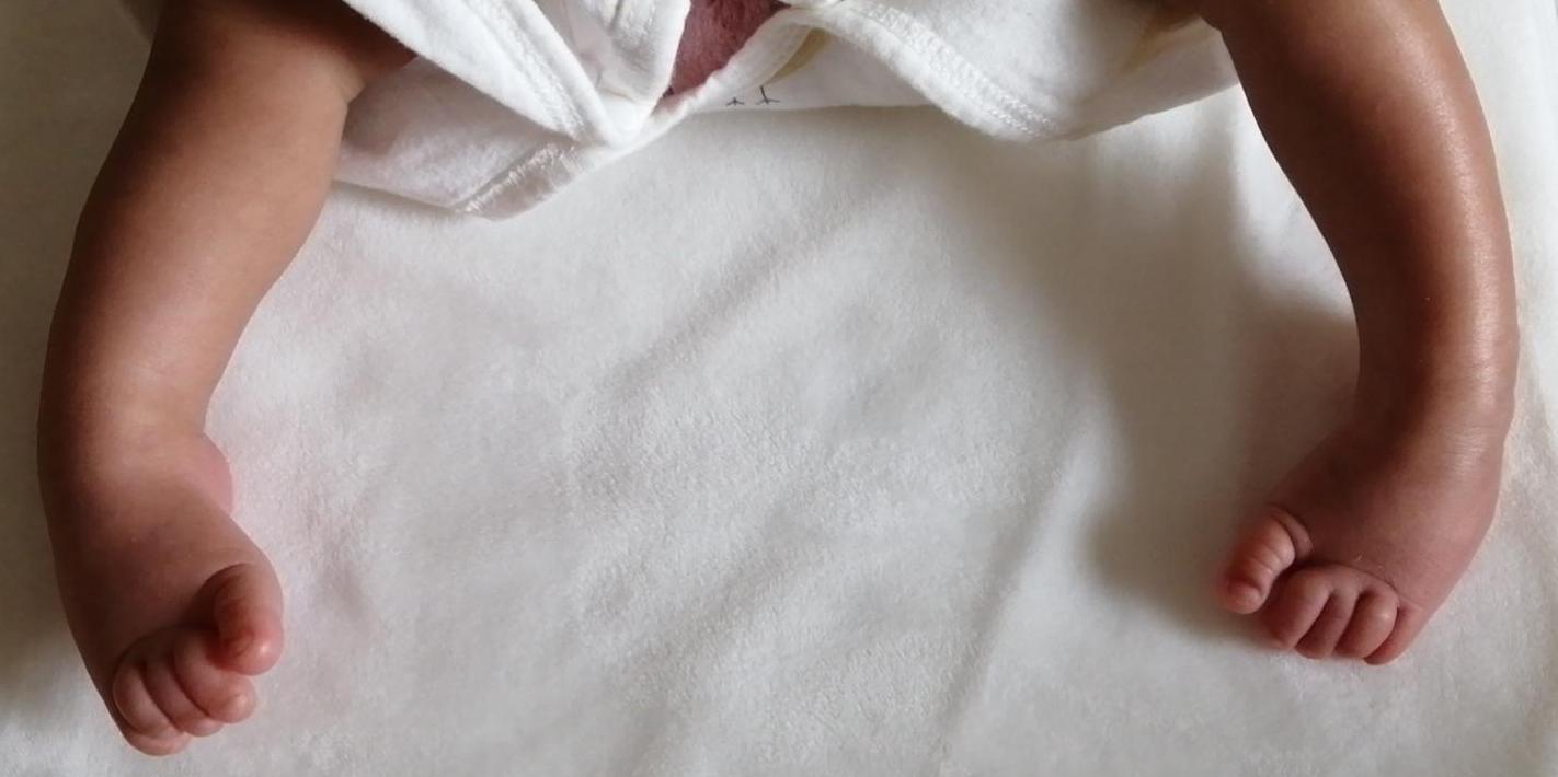 足内翻矫正鞋真的可以矫正吗,马蹄内翻足矫正鞋要穿多久