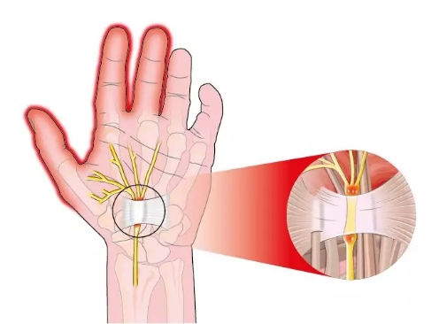 手腕受伤了怎么练肩,手受伤了怎么练瑜伽