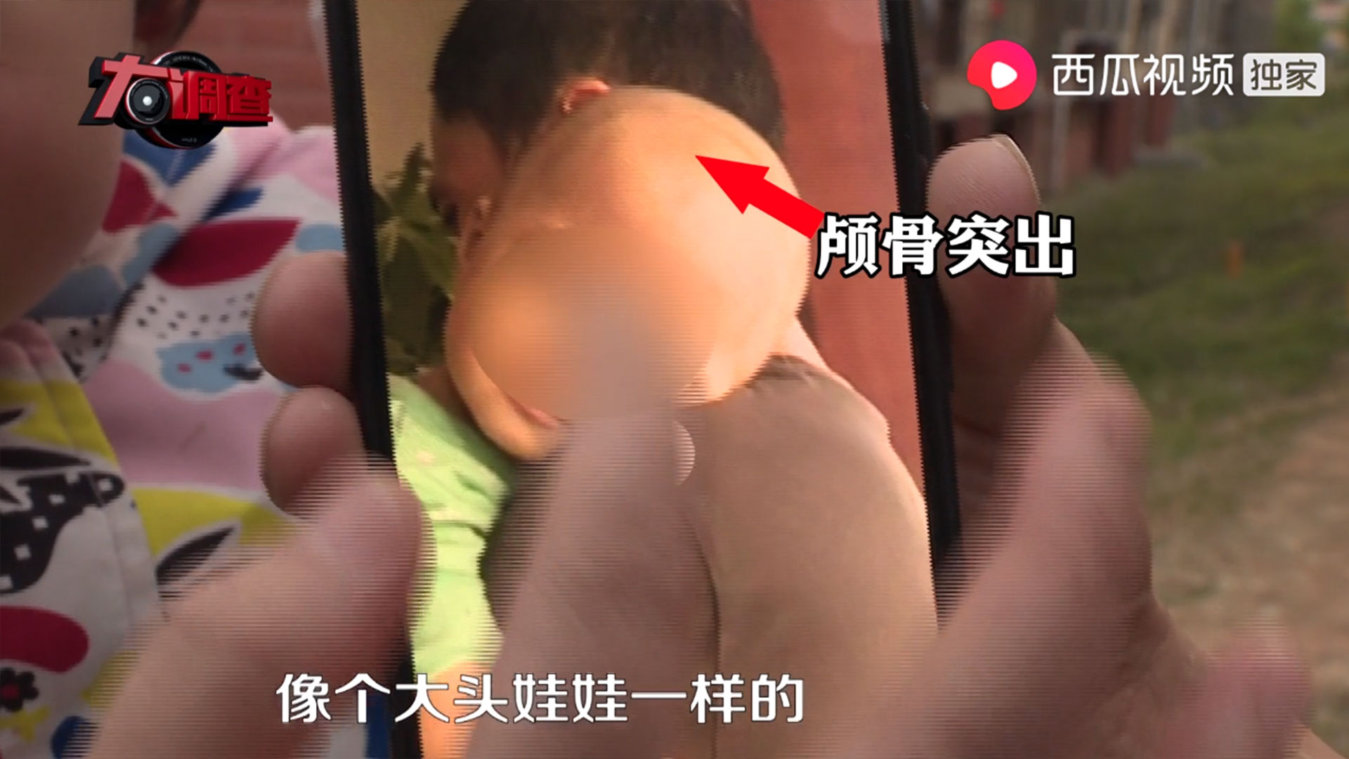 喝到假奶粉导致宝宝患病怎么办,食用假奶粉的孩子