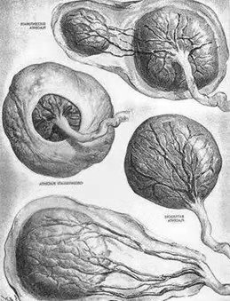 初期见红了没其他症状要去医院吗,怀孕初期见红了要不要马上去医院