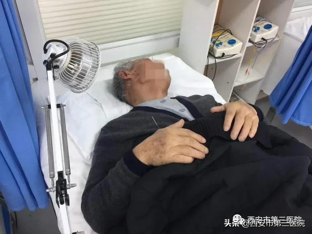 携手康复膝盖关节炎,面瘫能康复吗4年能康复吗