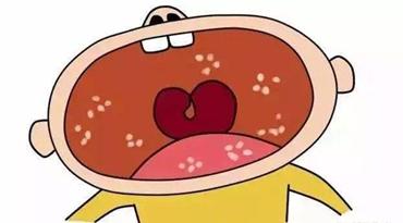 新手妈妈别惊慌，叫你搞定鹅口疮