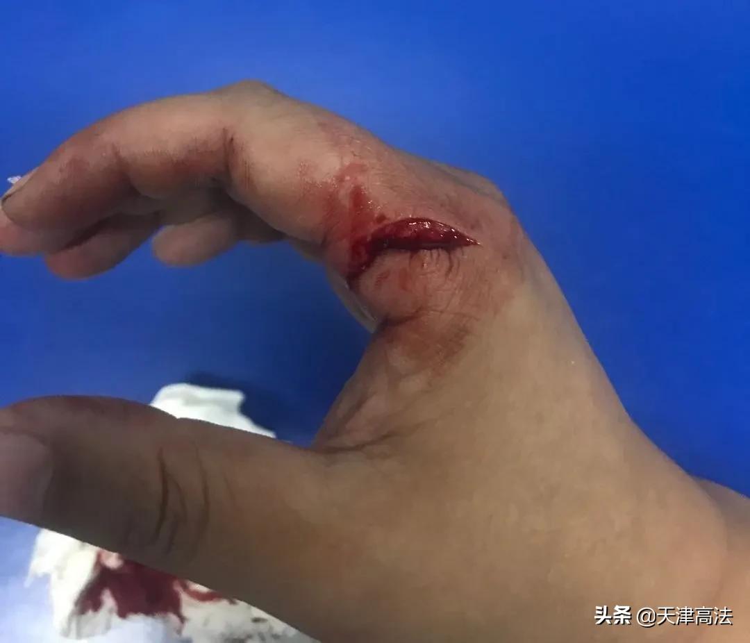 徒手夺刀是不是扯淡,徒手夺刀为什么那么多鲜血